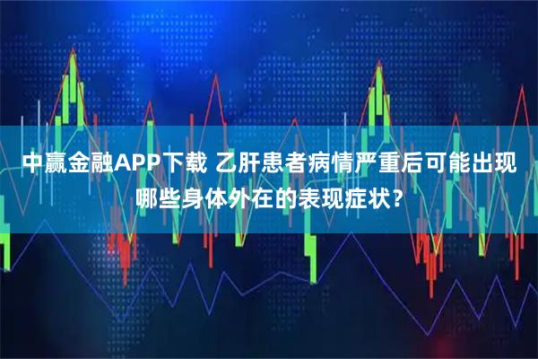 中赢金融APP下载 乙肝患者病情严重后可能出现哪些身体外在的表现症状？